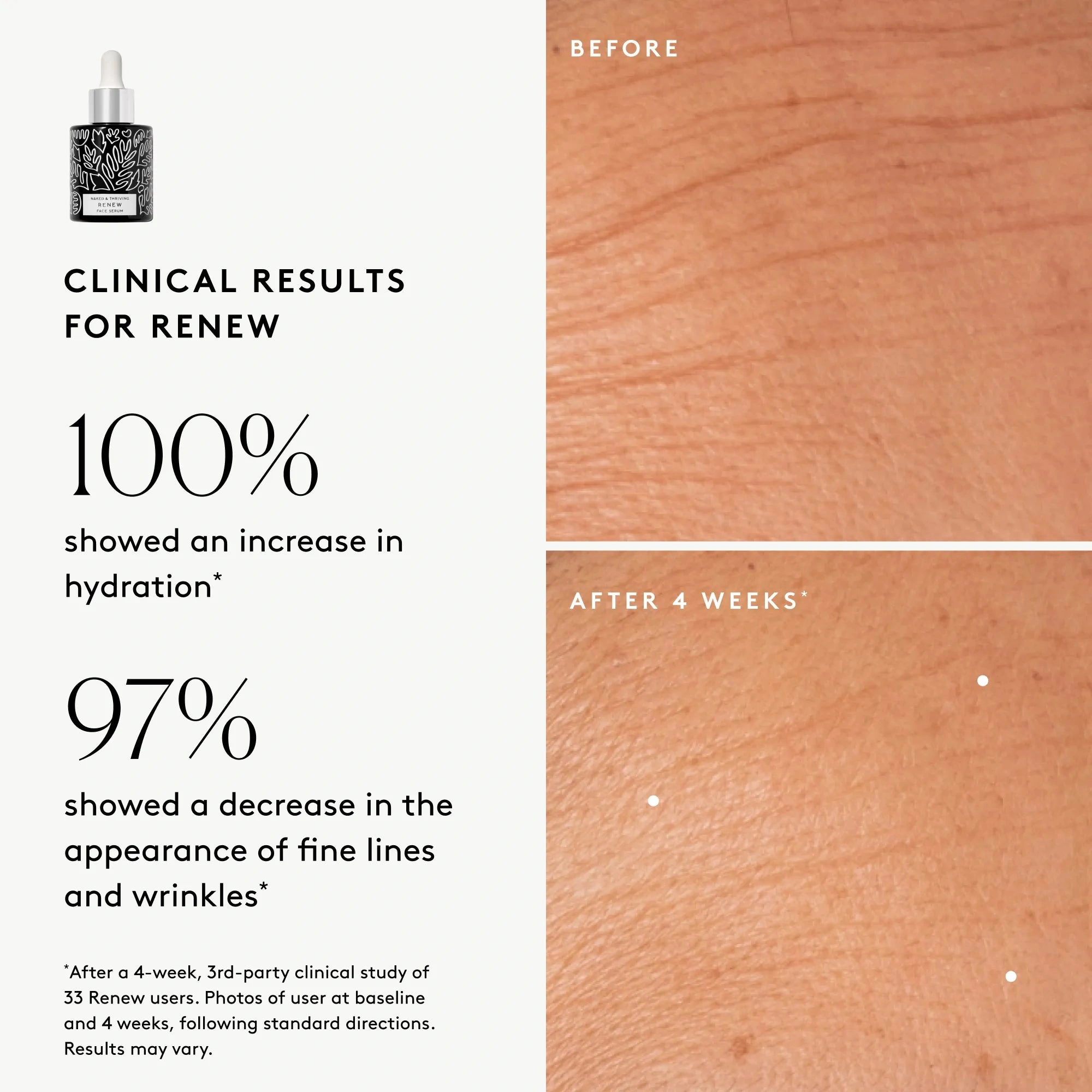 Clinical results chart for Renew Resurfacing Night Serum: 100% showed increased visible hydration and 97% showed improved visible wrinkles